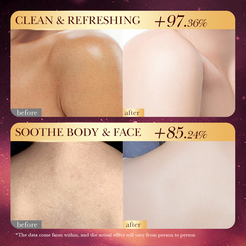 로즈 골드 포일 수제 비누 – 천연 에센셜 오일 보습  - Luxury Skincare Gifts For Women 리뷰 및 가격
